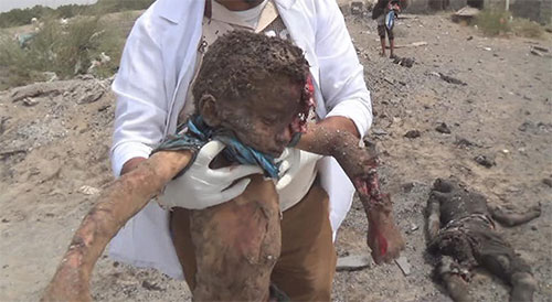 masacre de la agresión Saudí en Yemen Nueva masacre de la agresión Saudí en Yemen